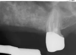 Dental X-Ray