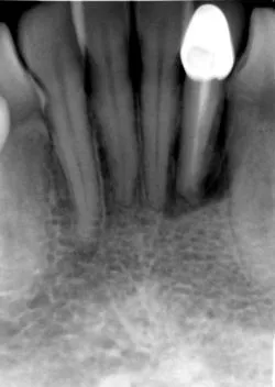 Before dental treatment