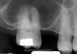 Before dental treatment
