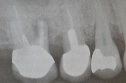 Before dental treatment