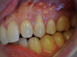 Before dental treatment